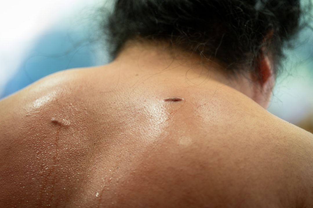 Sweaty back with two small scars